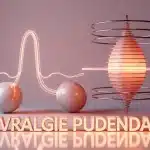 Illustration de la névralgie pudendale et du stress sur le nerf